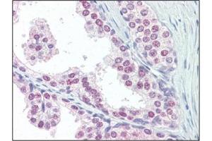 Immunohistochemistry: UBA52 antibody staining of Formalin-Fixed, Paraffin-Embedded Human Prostate followed by biotinylated goat anti-rabbit IgG secondary antibody, alkaline phosphatase-streptavidin and chromogen. (UBA52 antibody  (C-Term))