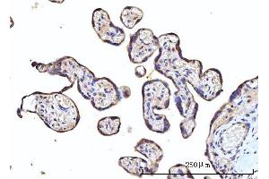 IHC analysis of RPS5 using anti-RPS5 antibody (ABIN7599076). (RPS5 antibody  (AA 1-204))