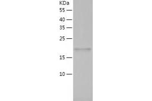 Western Blotting (WB) image for Peptidylprolyl Isomerase H (Cyclophilin H) (PPIH) (AA 2-177) protein (His tag) (ABIN7284423) (PPIH Protein (AA 2-177) (His tag))