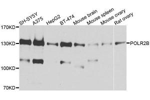 Western blot analysis of extracts of various cell lines, using POLR2B antibody. (POLR2B antibody  (AA 1-260))