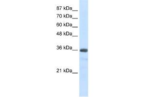WB Suggested Anti-U1SNRNPBP Antibody Titration:  2. (SNRNP35 antibody  (N-Term))