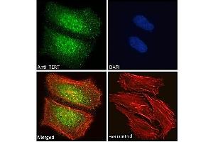 ABIN940568 Immunofluorescence analysis of paraformaldehyde fixed HeLa cells, permeabilized with 0. (TERT antibody  (AA 597-611))