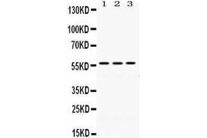 Western Blotting (WB) image for anti-Protein Disulfide Isomerase Family A, Member 3 (PDIA3) (AA 471-505), (C-Term) antibody (ABIN3043898) (PDIA3 antibody  (C-Term))