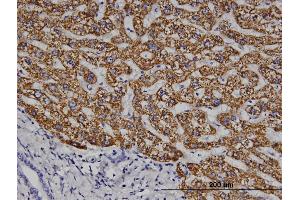 Immunoperoxidase of monoclonal antibody to ELA1 on formalin-fixed paraffin-embedded human liver. (CELA1 antibody  (AA 159-257))