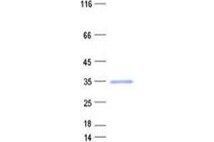 Validation with Western Blot (OSR2 Protein (His tag))