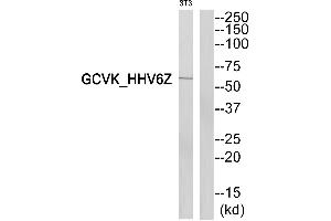 Western blot analysis of extracts from 3T3cells, using GCVK_HHV6Z antibody. (GCVK_HHV6Z antibody)