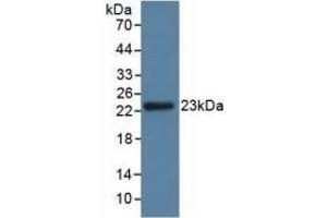 Detection of GPX3 in Rat Kidney Tissue using Polyclonal Antibody to Glutathione Peroxidase 3, Plasma (GPX3) (GPX3 antibody  (AA 3-72))