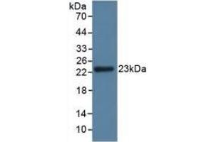 Detection of GPX3 in Rat Kidney Tissue using Polyclonal Antibody to Glutathione Peroxidase 3, Plasma (GPX3)