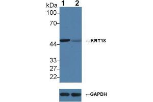 Western blot analysis of (1) Wild-type HeLa cell lysate, and (2) KRT18 knockout HeLa cell lysate, using Rabbit Anti-Human KRT18 Antibody (2 µg/ml) and HRP-conjugated Goat Anti-Mouse antibody ( (Cytokeratin 18 antibody  (AA 238-396))