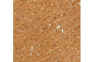 IHC analysis of SPTBN2 using anti-SPTBN2 antibody (ABIN7602111).