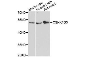 Western blot analysis of extracts of various cell lines, using CSNK1G3 antibody. (CSNK1G3 antibody  (AA 304-423))