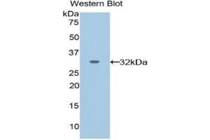 Western blot analysis of the recombinant protein. (EPHA1 antibody  (AA 716-960))
