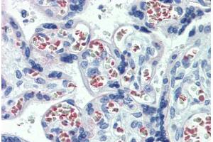 Human Placenta: Formalin-Fixed, Paraffin-Embedded (FFPE) (ABHD5 antibody  (C-Term))