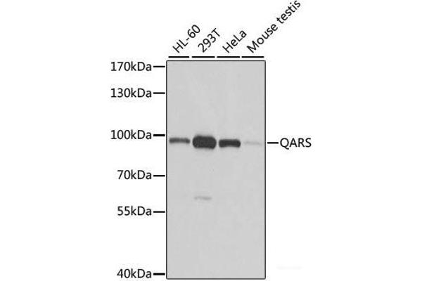 QARS antibody