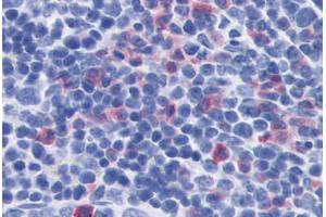 Mouse Spleen: Formalin-Fixed, Paraffin-Embedded (FFPE) (IL-17 antibody)