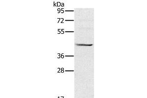 Western Blot analysis of Raji cell using MVK Polyclonal Antibody at dilution of 1:550 (MVK antibody)