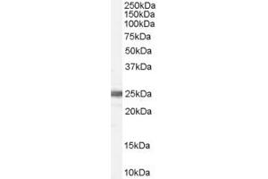 Western Blotting (WB) image for anti-Ribosomal Protein L19 (RPL19) (AA 106-118) antibody (ABIN297578)