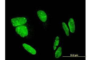 Immunofluorescence of monoclonal antibody to FLJ23834 on HeLa cell. (CDHR3 antibody  (AA 776-885))