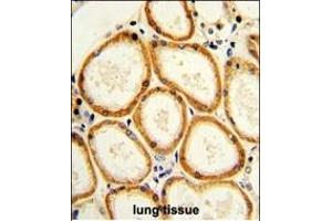 Formalin-fixed and paraffin-embedded human lung with CASP2 Antibody (Center), which was peroxidase-conjugated to the secondary antibody, followed by DAB staining. (Caspase 2 antibody  (AA 198-226))
