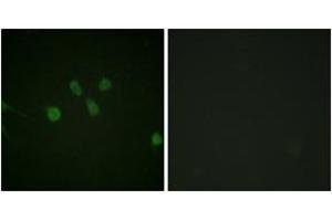 Immunofluorescence analysis of NIH-3T3 cells, using MAD1 (Ab-428) Antibody.
