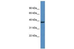 Image no. 1 for anti-Growth Hormone Inducible Transmembrane Protein (GHITM) (AA 161-210) antibody (ABIN6746279) (GHITM antibody  (AA 161-210))