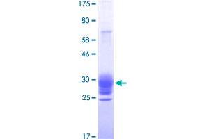 Image no. 1 for Tumor Necrosis Factor (Ligand) Superfamily, Member 15 (TNFSF15) (AA 72-251) protein (His-DYKDDDDK-Strep II Tag) (ABIN1323235)