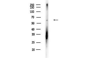 anti-Dyskeratosis Congenita 1, Dyskerin (DKC1) (Internal Region) antibody