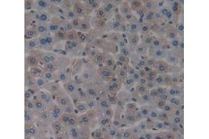 Used in DAB staining on fromalin fixed paraffin- embedded Kidney tissue (EIF2D antibody  (AA 360-570))
