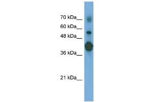 WB Suggested Anti-PTX3 Antibody Titration: 0. (PTX3 antibody  (N-Term))