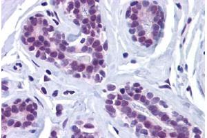 Human Breast: Formalin-Fixed, Paraffin-Embedded (FFPE) (Retinoblastoma Binding Protein 8 antibody  (Internal Region))