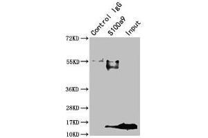 Immunoprecipitating S100a9 in Mouse spleen tissue Lane 1: Rabbit control IgG instead of ABIN7177798 in Mouse spleen tissue. (S1A9 (AA 2-113) antibody)