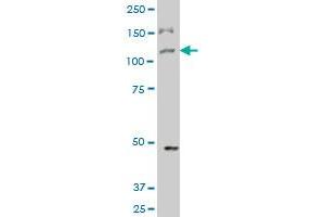 TRIM33 polyclonal antibody (A01), Lot # UCB5060208QCS1 Western Blot analysis of TRIM33 expression in Hela S3 NE . (TRIM33 antibody  (AA 1006-1105))