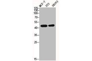 Western Blot analysis of MCF7 NIH-3T3 SKOV3 cells using ICAD Polyclonal Antibody (DFFA antibody  (Internal Region))