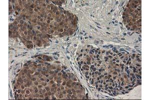 Image no. 2 for anti-Sepiapterin Reductase (SPR) antibody (ABIN1501111) (SPR antibody)