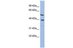 Image no. 1 for anti-Oleoyl-ACP Hydrolase (OLAH) (AA 35-84) antibody (ABIN6744030) (OLAH antibody  (AA 35-84))
