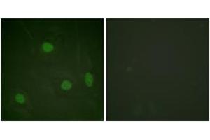 Immunofluorescence analysis of HeLa cells, using Histone H3 (Acetyl-Lys23) Antibody. (Histone 3 antibody  (H3K23ac))