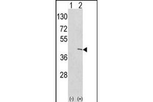 Western blot analysis of EKI1 (arrow) using rabbit polyclonal hEKI1-C3 (ABIN391086 and ABIN2841227). (Ethanolamine Kinase 1 antibody  (N-Term))