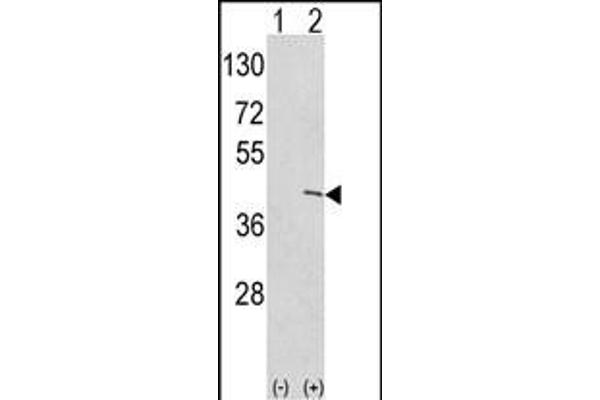 Ethanolamine Kinase 1 anticorps  (N-Term)