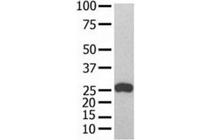 GST Tag antibody used in western blot with recombinant protein