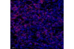 Immunofluorescence (Paraffin-embedded Sections) (IF (p)) image for anti-CD3 (CD3) antibody (ABIN7073386)