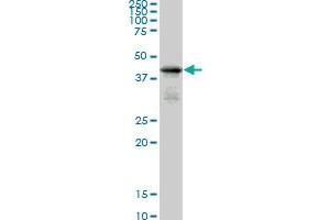 SMAD7 monoclonal antibody (M05), clone 2G6. (SMAD7 antibody  (AA 160-260))