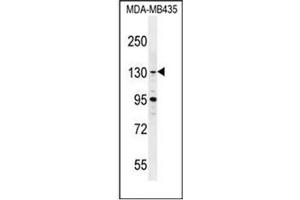Western blot analysis of GLTSCR1 Antibody (Center) in MDA-MB435 cell line lysates (35ug/lane). (Gltscr1 antibody  (Middle Region))