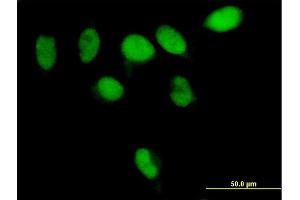Immunofluorescence of purified MaxPab antibody to PARG on HeLa cell.
