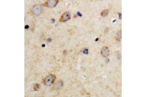 Immunohistochemical analysis of MAP2 staining in human brain formalin fixed paraffin embedded tissue section. (MAP2 antibody  (N-Term))