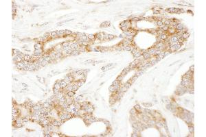 Immunohistochemistry (IHC) image for anti-CAP-GLY Domain Containing Linker Protein 1 (CLIP1) (AA 1388-1438) antibody (ABIN7454913)