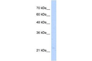 Western Blot showing NUDT16L1 antibody used at a concentration of 1-2 ug/ml to detect its target protein. (NUDT16L1 antibody)