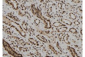 ABIN6273108 at 1/100 staining Human kidney tissue by IHC-P. (DBR1 antibody)