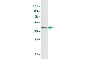 Western Blot detection against Immunogen (35. (ATP2B4 antibody  (AA 1-92))