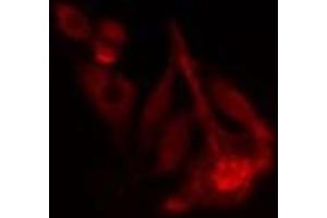 ABIN6277795 staining  Hela cells by IF/ICC. (PRKACB antibody  (pThr197))