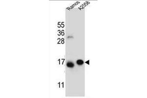 EIF5AL1 antibody  (C-Term)